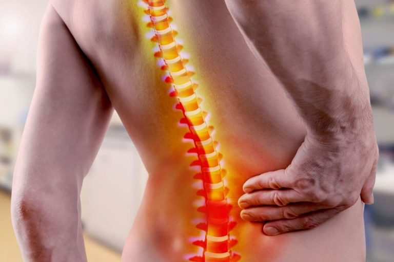 Dolor lumbar o lumbalgia 2